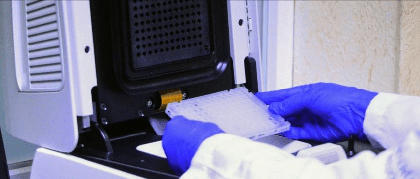 Confirma SST 15 casos nuevos positivos a COVID-19 en el estado